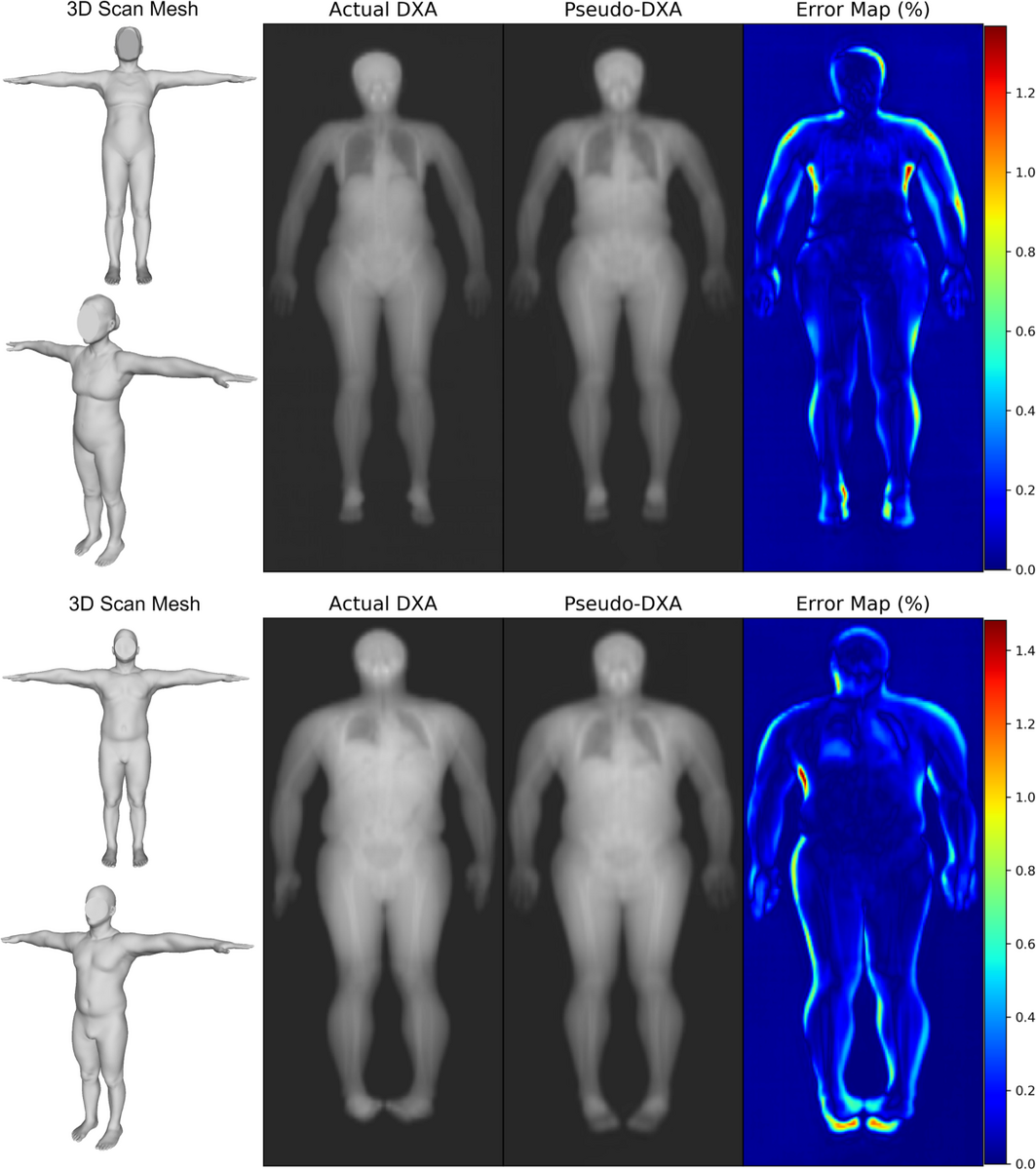 Generative Deep Learning Furthers The Understanding Of Local Distributions Of Fat And Muscle On Body Shape And Health Using 3D Surface Scans Communications Medicine Generative Deep Learning Furthers The Understanding Of Local Distributions Of Fat And Muscle On Body Shape And Health Using 3D Surface Scans Communications Medicine