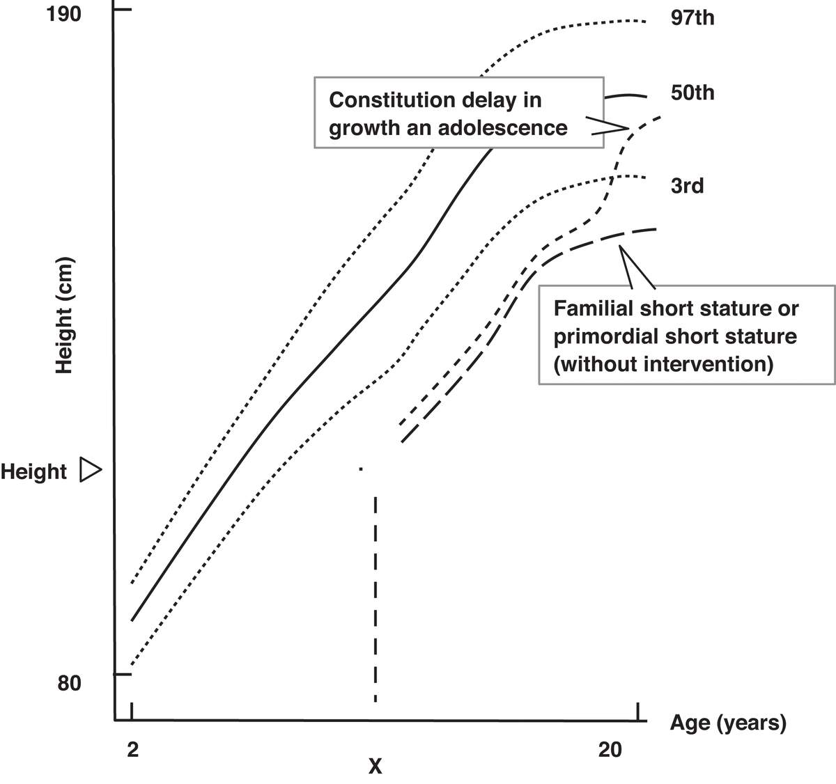 Laboratory Evaluation Of Short Stature In Children Oncohema Key